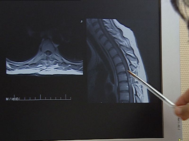 Los tratamientos con células madre que se ofrecen fuera de los ensayos clínicos oficiales no están autorizados y pueden ser perjudiciales - Ciencia y tecnología en Rtve.es | Ver