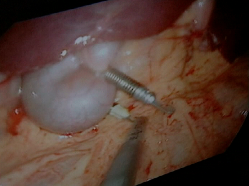 Panorama regional - 06/05/10 - Panorama Regional | Ver