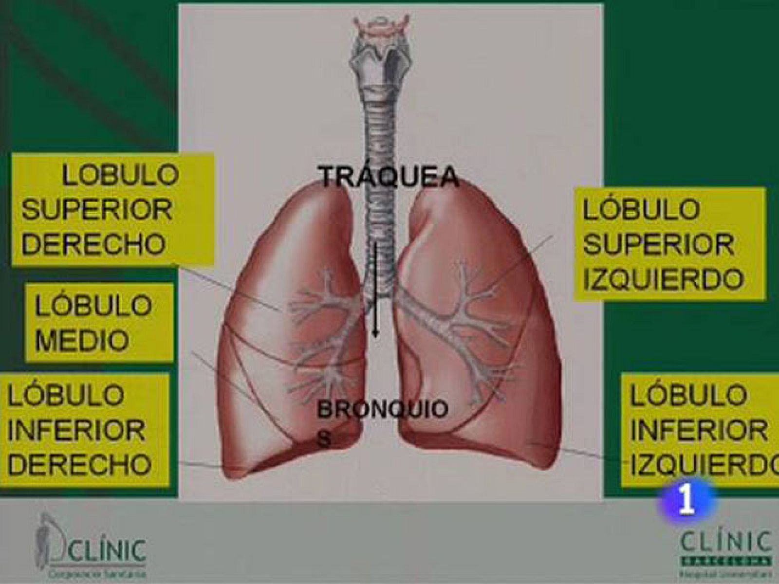 Así ha sido la operación del Rey | Ver