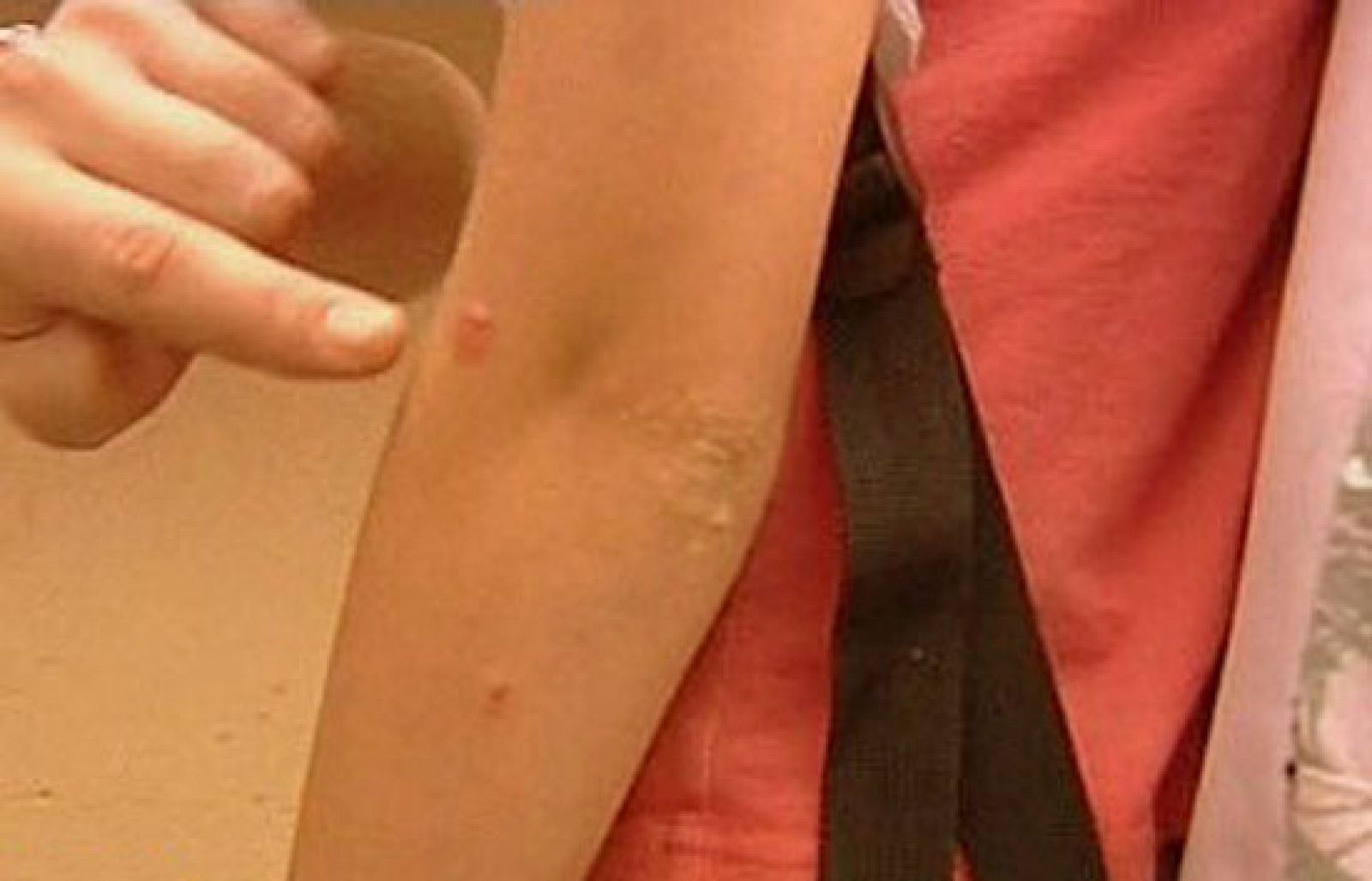 España Directo - Devorados por los mosquitos | Ver