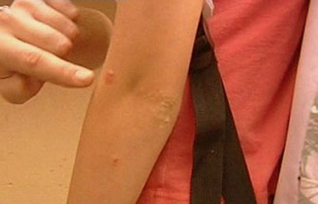 España Directo - Devorados por los mosquitos