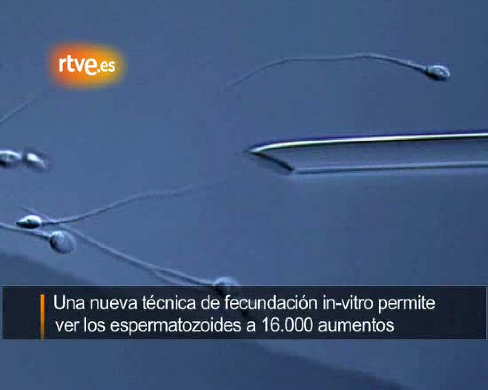 'Casting' de espermatozoides