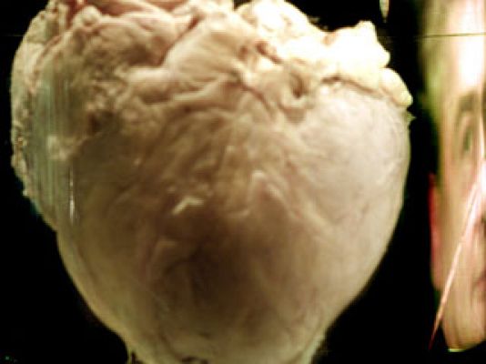 Premios Princesa de Asturias - Organizaciones de trasplantes