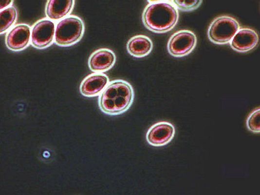 Universo UNED - Los microorganismos