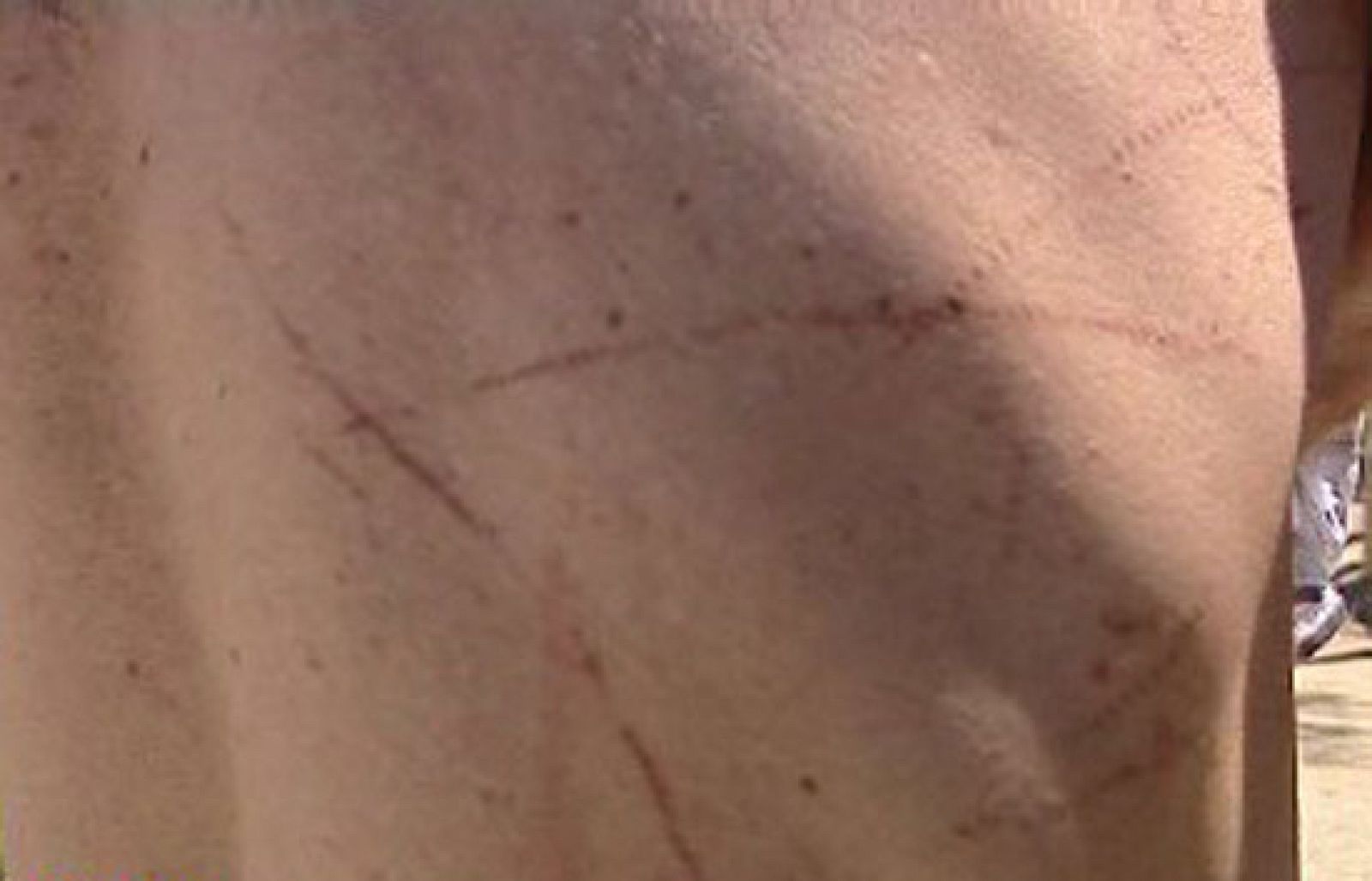 España Directo - Víctima de la carabela portuguesa | Ver