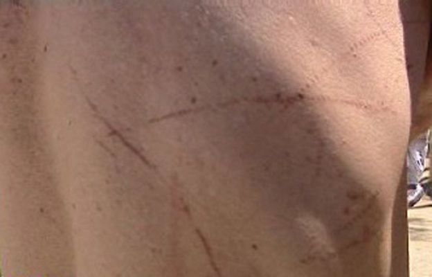 España Directo - Víctima de la carabela portuguesa