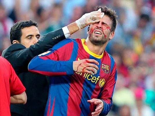  - El Barça, a curarse en la Champions