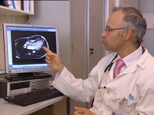 Ciencia y tecnología en Rtve.es - Cada cinco segundos un infarto