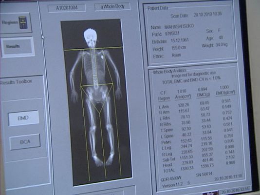 Informativo de Madrid - Informativo de Madrid - 20/10/10