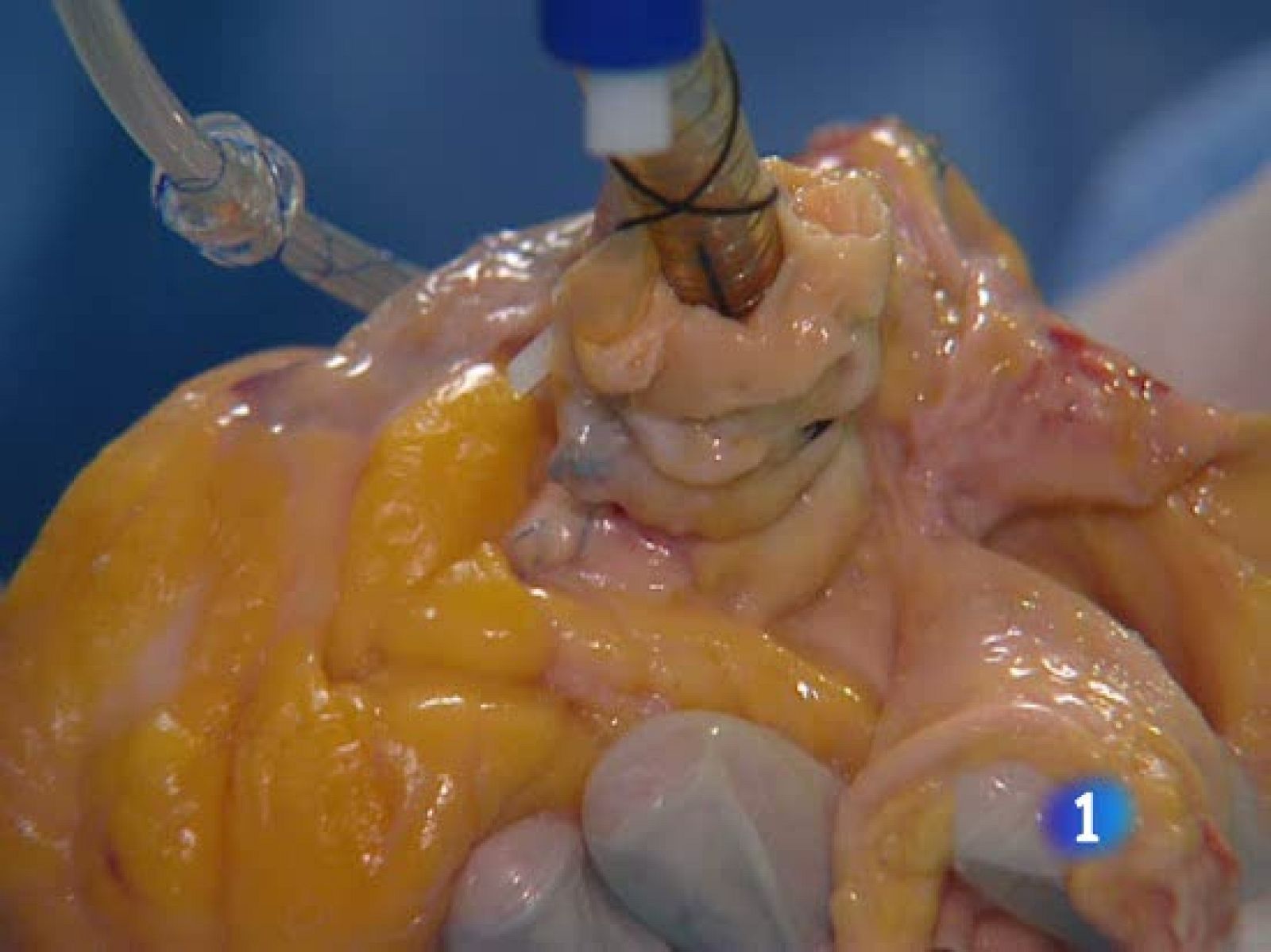 Primer laboratorio del mundo que fabricará órganos bioartificiales con células madre