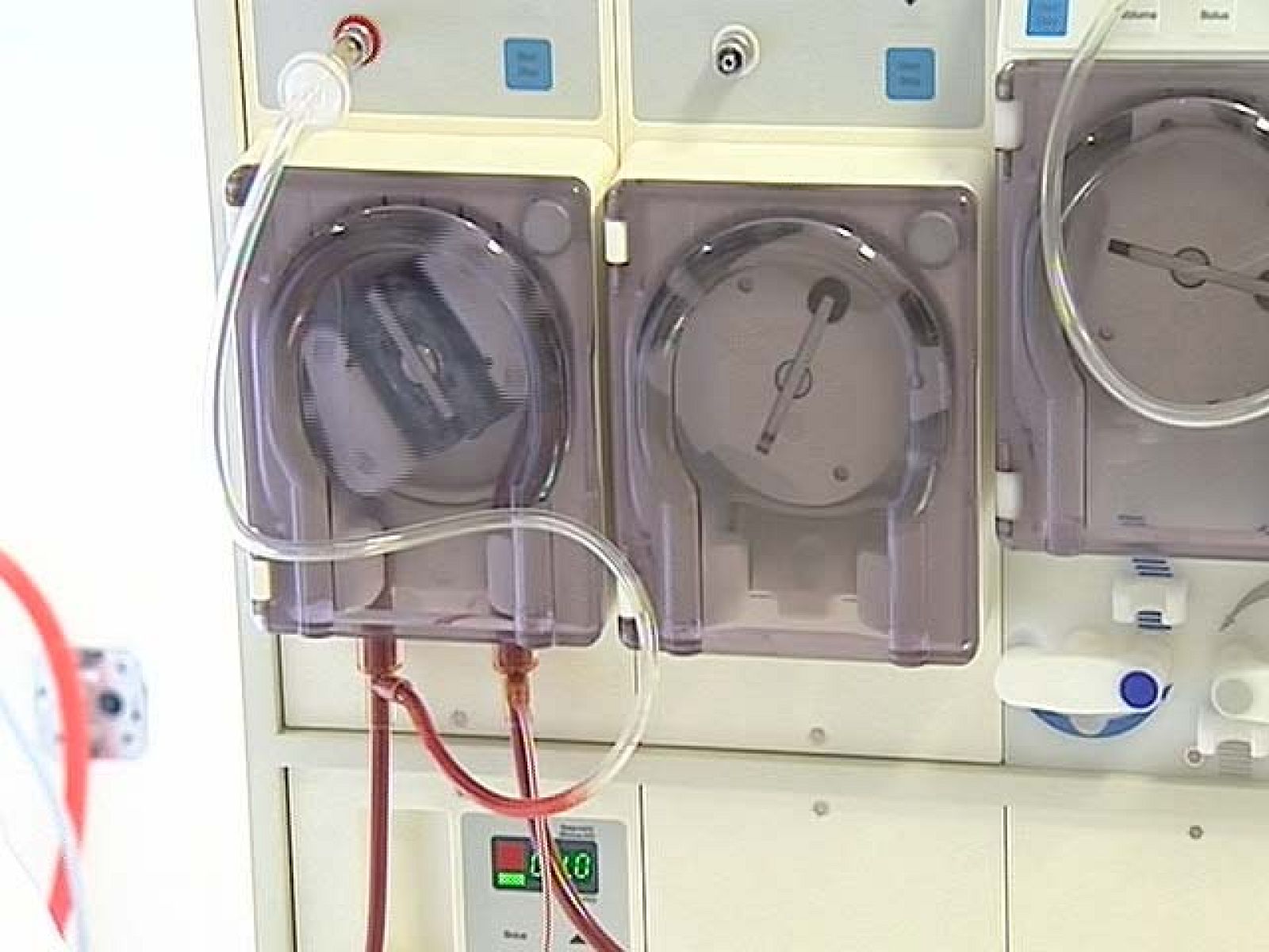 Analizan si 56 personas han contraído hepatitis C en un centro de hemodiálisis de Inca (Mallorca)