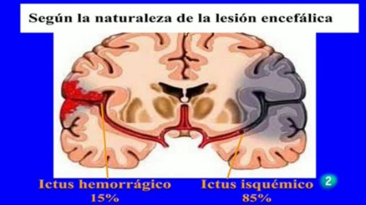 Para todos La 2 - Para todos La 2 - 13/12/10