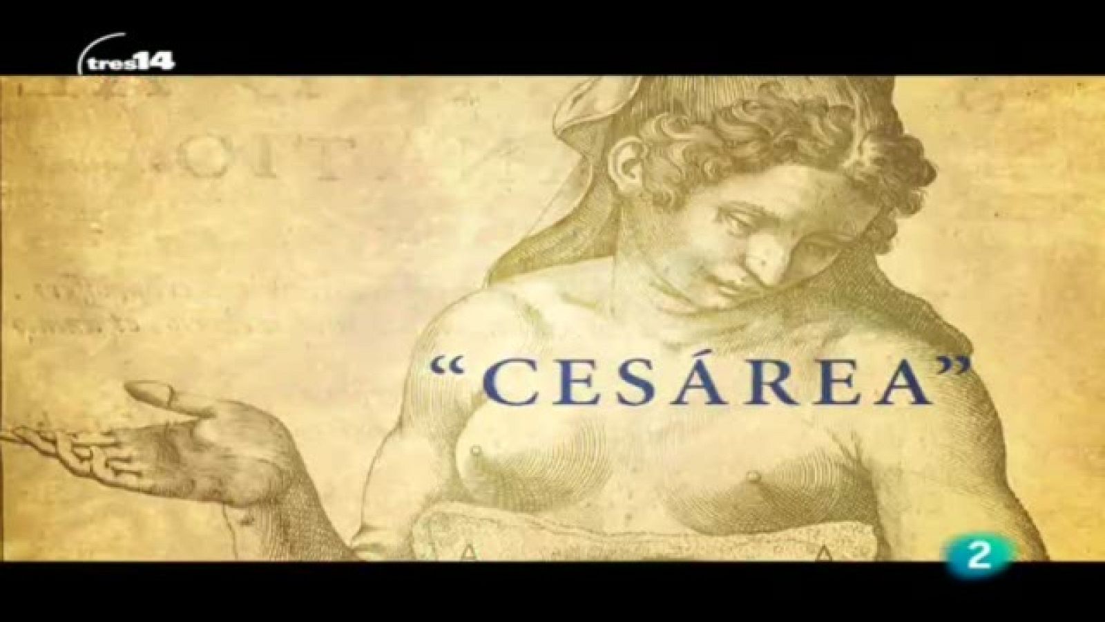 tres14 - La cesárea - tres14 | Ver