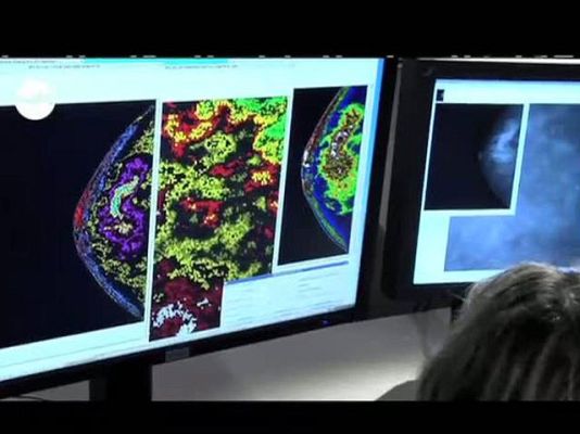 tres14 - Avance técnicas de imagen