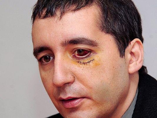  - El consejero: "He vuelto a nacer"